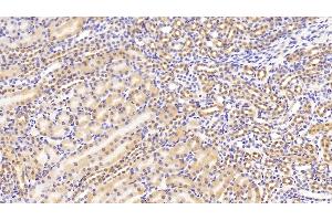 Detection of NME1 in Mouse Kidney Tissue using Polyclonal Antibody to Non Metastatic Cells 1, Protein NM23A Expressed In (NME1)
