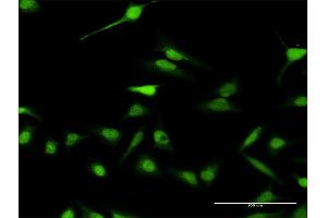 Immunofluorescence of purified MaxPab antibody to ABI2 on HeLa cell. (ABI2 anticorps  (AA 1-475))