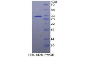 SDS-PAGE analysis of Human Insulin Like Growth Factor 2 Receptor (IGF2R) Protein. (IGF2R Protéine)