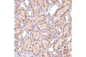 Immunohistochemistry of paraffin-embedded rat kidney using Transportin 3 (Transportin 3 (TNPO3)) Rabbit mAb (ABIN7270971) at dilution of 1:100 (40x lens).