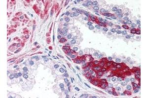 Image no. 1 for anti-ADAM Metallopeptidase Domain 12 (ADAM12) (N-Term) antibody (ABIN372949) (ADAM12 anticorps  (N-Term))