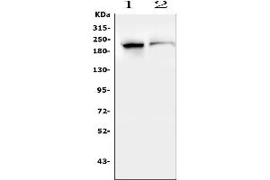 Western blot analysis of SMARCA2 using anti-SMARCA2 antibody (ABIN7600367).