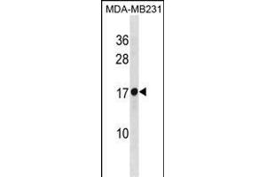 RPL30 Antibody (N-term) (ABIN1881761 and ABIN2838833) western blot analysis in MDA-M cell line lysates (35 μg/lane). (RPL30 anticorps  (N-Term))