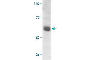 Western blot analysis of IL22RA1 expression in human HepG2 cell lysate with IL22RA1 polyclonal antibody  at 1 ug /mL . (IL22 Receptor alpha 1 anticorps  (AA 560-574))