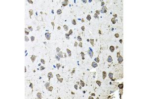 Immunohistochemistry of paraffin-embedded mouse brain using FGF1 antibody. (FGF1 anticorps)