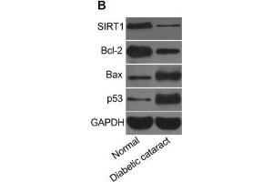 Expression of miR-211 and mRNA and protein expressions of SIRT1, Bcl-2, Bax, and p53 in lens tissues of mice(A) miR-211 expression and mRNA and protein expressions of SIRT1, Bcl-2, Bax, and p53 in mice lens, (B) strip chart of SIRT1, Bcl-2, Bax, and p53 proteins, (C) expressions of SIRT1, Bcl-2, Bax, and p53 proteins in mice lens, *, P<0. (Trefoil Factor 2 anticorps  (AA 51-129))