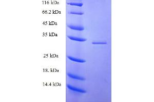 SDS-PAGE (SDS) image for p52K (FAV1GP06) (AA 612-761), (partial) protein (His-SUMO Tag) (ABIN5710147)