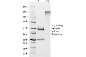 SDS-PAGE Analysis Purified GP2 Mouse Monoclonal Antibody (GP2/1803). (GP2 anticorps  (AA 35-179))