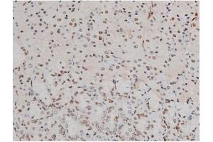 ABIN6256594 and ABIN6267389 at 1/200 staining Rat ganstric tissue sections by IHC-P. (ATF2 anticorps  (pThr51, pThr69))