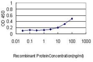 Detection limit for recombinant GST tagged IL11RA is approximately 0. (IL11RA anticorps  (AA 1-422))