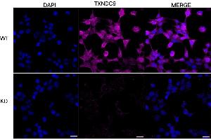Immunocytochemical staining of HeLa cells using TXNDC9 antibody (ABIN7800543), 1:1,000), Top panel: wild-type (WT), Bottom panal: TXNDC9 shRNA knockdown (KD). (Recombinant TXNDC9 anticorps)