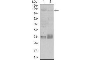 Western blot analysis using ITGB1 mouse mAb against A549 (1), and Jurkat (2) cell lysate. (ITGB1 anticorps)