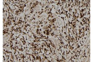 ABIN6278767 at 1/100 staining Human gastric tissue by IHC-P. (LMO7 anticorps  (C-Term))