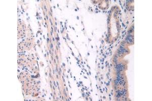 Used in DAB staining on fromalin fixed paraffin- embedded Kidney tissue