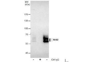 IP Image Immunoprecipitation of NAB2 protein from Jurkat whole cell extracts using 5 μg of NAB2 antibody, Western blot analysis was performed using NAB2 antibody, EasyBlot anti-Rabbit IgG  was used as a secondary reagent. (NAB2 anticorps)