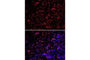 Immunofluorescence analysis of U20S cell using ENOX2 antibody. (ENOX2 anticorps)