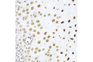 Immunohistochemistry of paraffin-embedded human esophagus using SSB antibody at dilution of 1:100 (40x lens). (SSB anticorps)