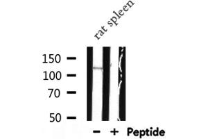 Western blot analysis of RAD51 expression in Rat spleen lysate (Golgin A2 (GOLGA2) (N-Term) anticorps)
