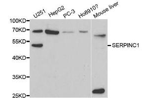 Western blot analysis of extracts of various cell lines, using SERPINC1 antibody. (SERPINC1 anticorps  (AA 33-185))