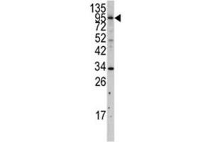 Western blot analysis of MYLK3 antibody and A375 lysate.