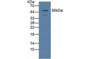 Detection of PSMD5 in Human Jurkat Cells using Polyclonal Antibody to Proteasome 26S Subunit, Non ATPase 5 (PSMD5)
