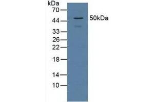 Detection of PSMD5 in Human Jurkat Cells using Polyclonal Antibody to Proteasome 26S Subunit, Non ATPase 5 (PSMD5) (Proteasome 26S Subunit, Non ATPase 5 (AA 143-341) anticorps)