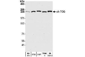 Western Blotting (WB) image for anti-Cytoskeleton Associated Protein 5 (CKAP5) (AA 1425-1475) antibody (ABIN7450110) (CKAP5 anticorps  (AA 1425-1475))