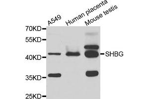Western blot analysis of extracts of various cell lines, using SHBG antibody.