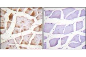 Immunohistochemistry analysis of paraffin-embedded human skeletal muscle tissue, using Actin-pan ( alpha/gamma)  (Ab-55/53) Antibody.