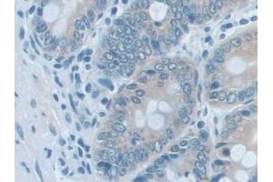 Detection of AK2 in Rat Colon Tissue using Polyclonal Antibody to Adenylate Kinase 2 (AK2)