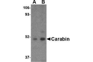 Image no. 1 for anti-TBC1 Domain Family, Member 10C (TBC1D10C) (C-Term) antibody (ABIN490812) (Carabin anticorps  (C-Term))