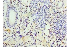 Immunohistochemistry of paraffin-embedded human pancreatic tissue using ABIN7156601 at dilution of 1:100 (IFNGR1 anticorps  (AA 270-489))