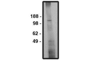 Image no. 1 for anti-Solute Carrier Family 9 (Sodium/hydrogen Exchanger), Member 6 (SLC9A6) antibody (ABIN793709) (SLC9A6 anticorps)