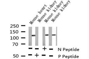 Western blot analysis of Phospho-NFAT4 (Ser165) expression in various lysates (NFATC3 anticorps  (pSer165))