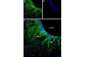 Expression of α2A-Adrenoreceptor in rat hypothalamus - Immunohistochemical staining of rat ventromedial hypothalamus free floating frozen section using Anti-α2A-Adrenergic Receptor (extracellular) Antibody (ABIN7042899, ABIN7043918 and ABIN7043919), (1:250).