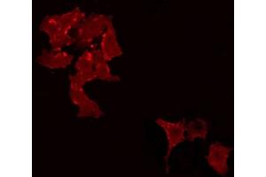 ABIN6266965 staining Hela by IF/ICC.