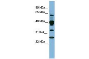 Image no. 1 for anti-Pleckstrin (PLEK) (N-Term) antibody (ABIN6741695) (Pleckstrin anticorps  (N-Term))