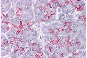 Human Pancreas: Formalin-Fixed, Paraffin-Embedded (FFPE)