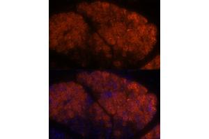 Immunofluorescence analysis of rat pancreas using PNLIPRP1 antibody (ABIN7269167) at dilution of 1:100.