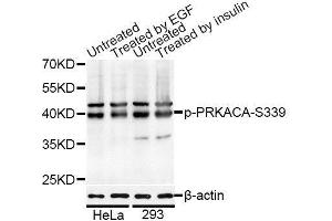 Western blot analysis of extracts of HeLa and 293 cells, using Phospho-PRKACA-S339 antibody (ABIN5995921) at 1/1000 dilution. (PRKACA anticorps  (pSer339))