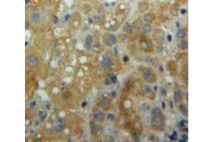 Used in DAB staining on fromalin fixed paraffin-embedded Liver tissue (ITGAL anticorps  (AA 809-1066))