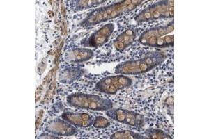 Immunohistochemical staining of human duodenum with SGEF polyclonal antibody  shows moderate cytoplasmic positivity in glandular cells as well as in the muscular layers.