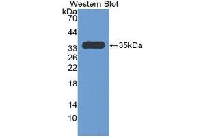 Detection of Recombinant Antithrombin, Rat using Polyclonal Antibody to Antithrombin (AT)