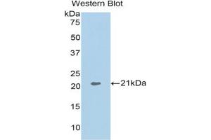 Western blot analysis of the recombinant protein. (ARPC4 anticorps  (AA 3-163))
