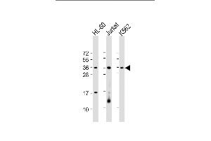 All lanes : Anti-RSPO1 Antibody (C-Term) at 1:2000 dilution Lane 1: HL-60 whole cell lysate Lane 2: Jurkat whole cell lysate Lane 3: K562 whole cell lysate Lysates/proteins at 20 μg per lane. (RSPO1 anticorps  (AA 206-240))