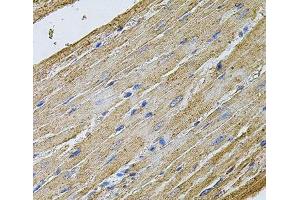 Immunohistochemistry of paraffin-embedded Rat heart using CDH16 Polyclonal Antibody at dilution of 1:100 (40x lens). (Cadherin-16 anticorps)