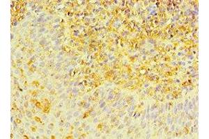 Immunohistochemistry of paraffin-embedded human tonsil tissue using ABIN7150706 at dilution of 1:100 (MAP2K3 anticorps  (AA 1-170))