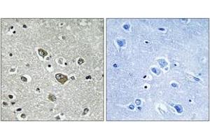 Immunohistochemistry analysis of paraffin-embedded human brain tissue, using ZDHHC9 Antibody.