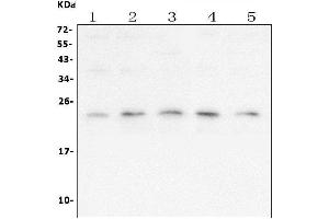 Western blot analysis of TFAM using anti ZO-1 antibody (ABIN7603113).