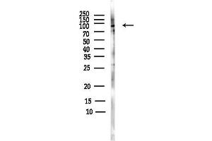 Western blot analysis of lysates from Rat brain, using Phospho-RSK1 p90 (Ser380) Antibody at 1/1000 dilution.